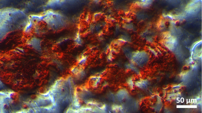 Osteogenic differentiation of human bone marrow mesenchymal stem cells (hBMSCs) on poly(styrene-co-acrylonitrile) surface with micro-scale roughness. (Bone cell-specific markers in red: alizarin red S)