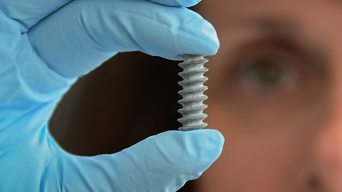 /imperia/md/images/hzg/institut_fuer_werkstoffforschung/banner_metallische_biomaterialien.jpg
